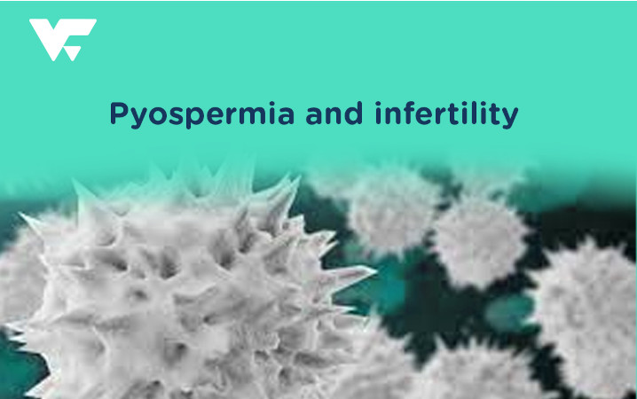 Pyospermia and Infertility